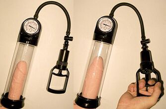 Penis enlargement of 3 to 4 cm in length in 1 day using a vacuum pump