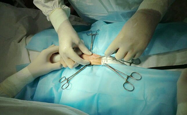 Surgery on the reproductive organ will help increase its size.